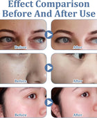 Before and after effect comparison on skin with blue text overlay.