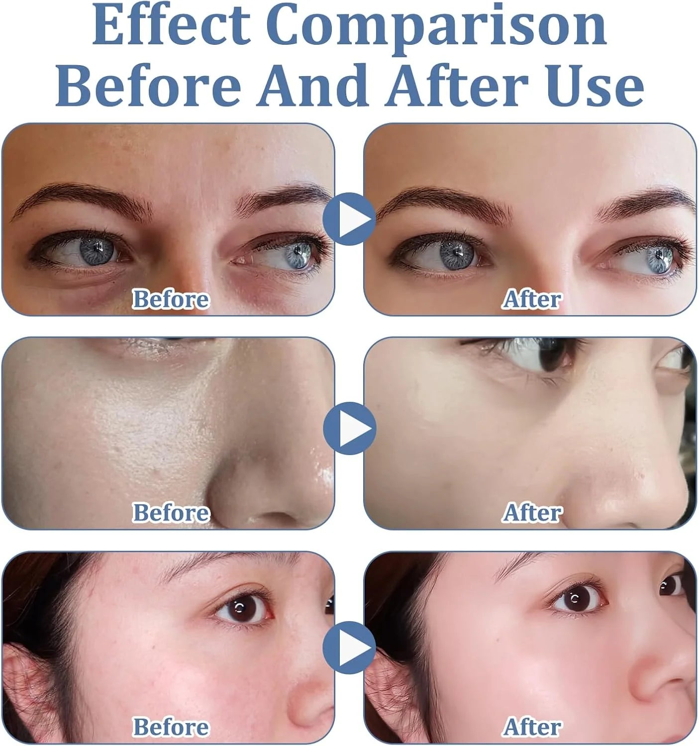 Before and after effect comparison on skin with blue text overlay.