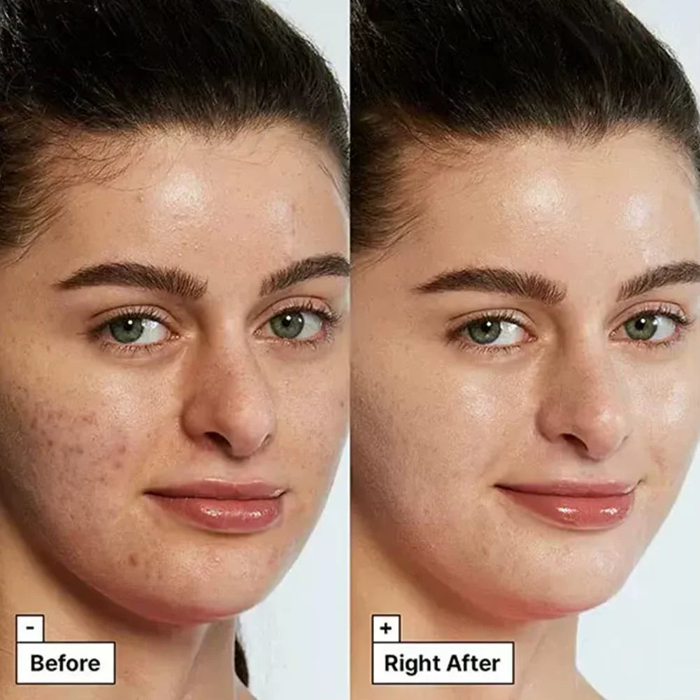 Cicapair Tiger Grass Color Correcting Cream 50Ml Color Correcting Treatment Repairing Sunscreen SPF22+ Face Skin Care